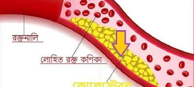 কোলেস্টেরল নিয়ন্ত্রণ করবেন কীভাবে?