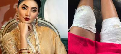 নাটকের শুটিং সেটে দুর্ঘটনার শিকার অভিনেত্রী সুনেরাহ বিনতে কামাল