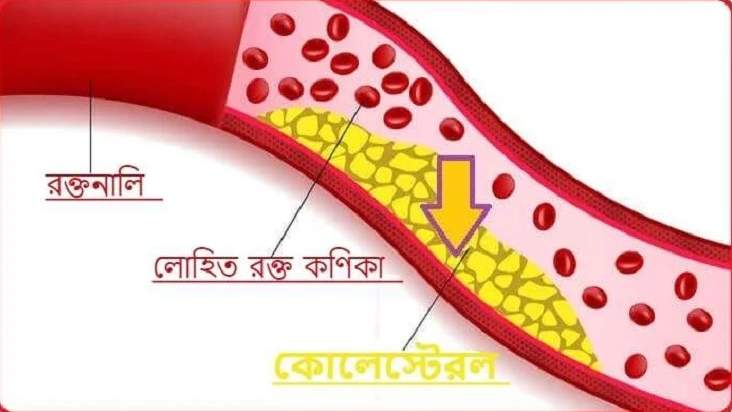 কোলেস্টেরল নিয়ন্ত্রণ করবেন কীভাবে?
